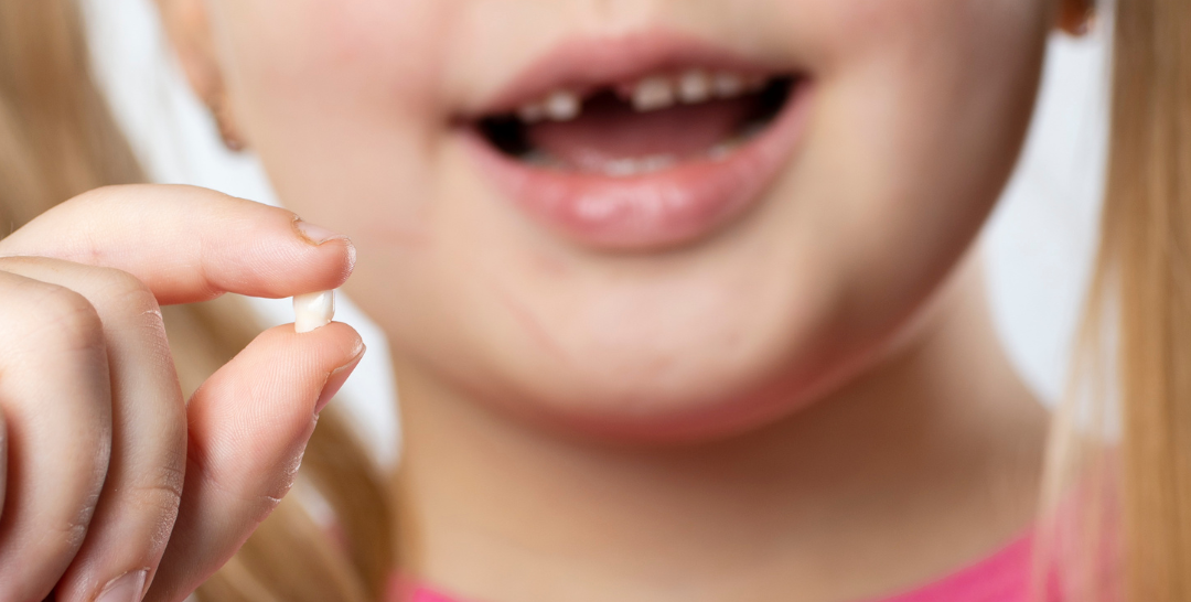 Quando que os dentes de leite das crianças caem?