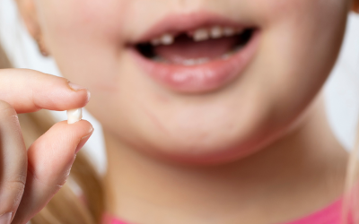 Quando que os dentes de leite das crianças caem?
